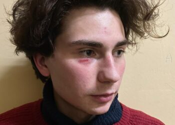 Fotograf dobio batine i oduzeta mu oprema za rad na protestu SNS-a u Šapcu