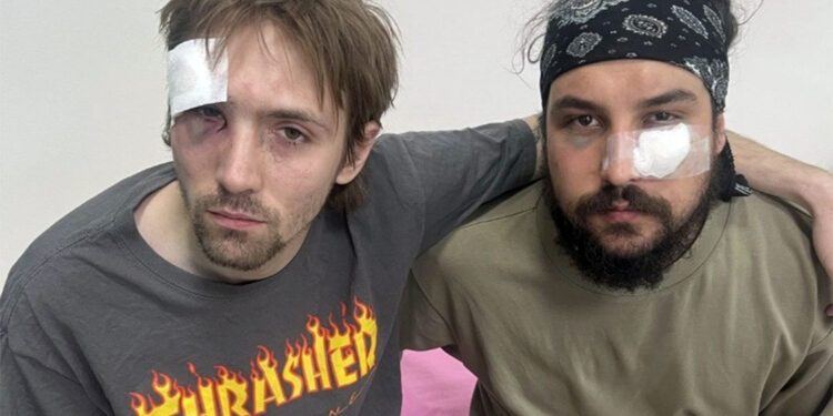 Pretučeni glasnici demokratije